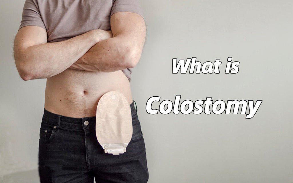 Understanding Colostomy - HEAGI - Colostomy bags Supplies