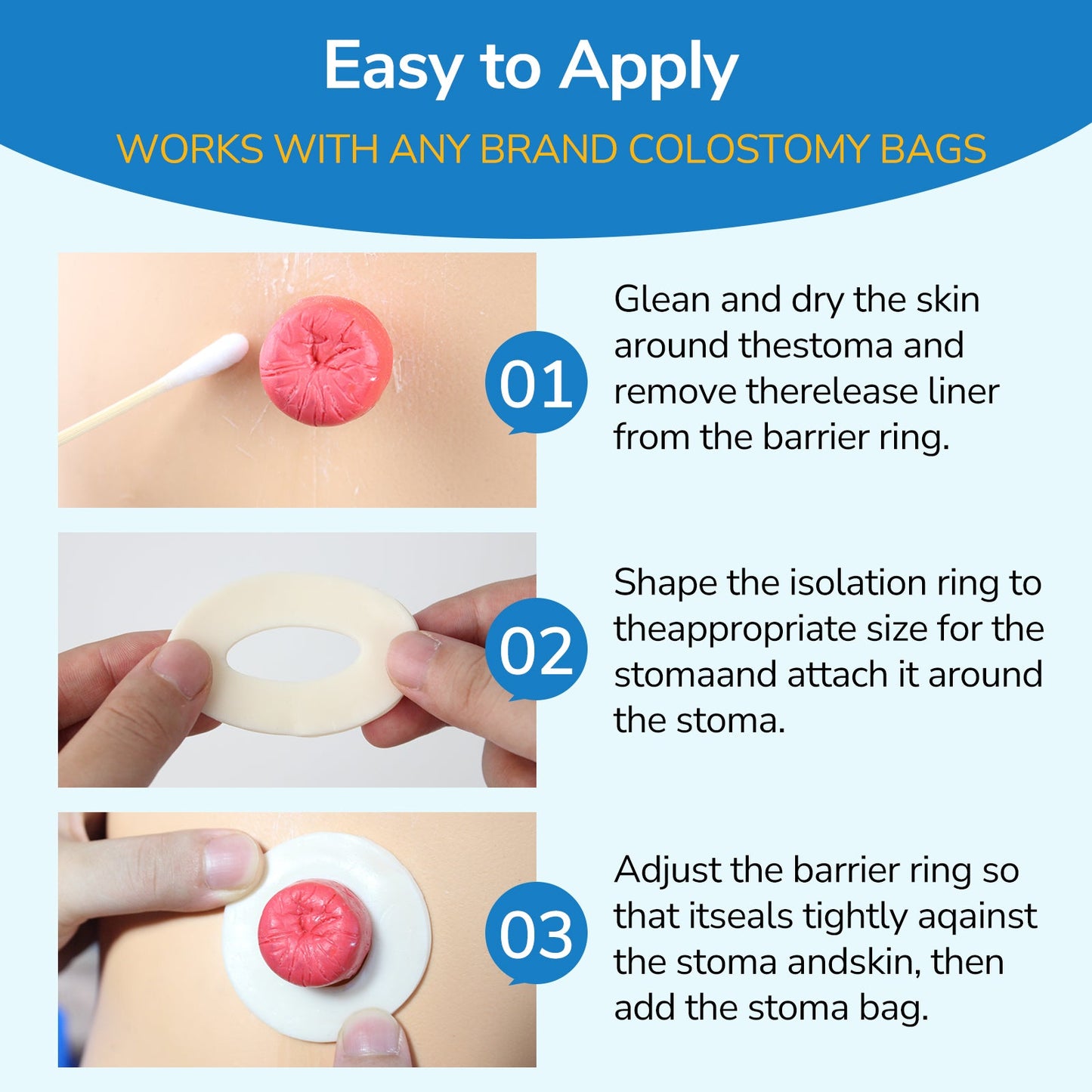 HEAGI Ostomy Barrier Rings Ostomy Supplies 4mm Thickness Moldable Ostomy Rings Medical Grade Hydrocolloid Adhesive - HEAGI - Colostomy bags Supplies