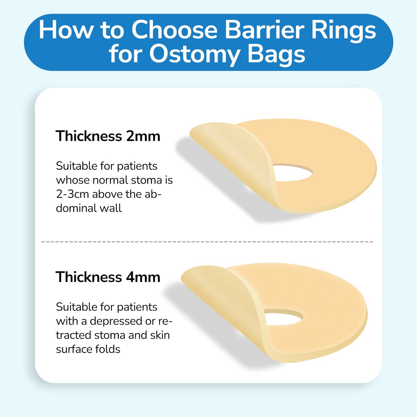 HEAGI Ostomy Barrier Rings Ostomy Supplies 4mm Thickness Moldable Ostomy Rings Medical Grade Hydrocolloid Adhesive - HEAGI - Colostomy bags Supplies