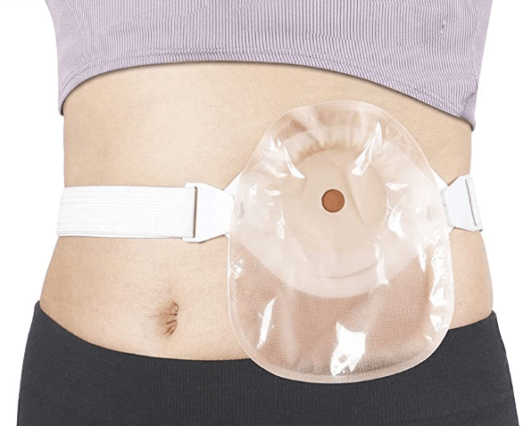 The role and use of stoma belt - HEAGI - Colostomy bags Supplies