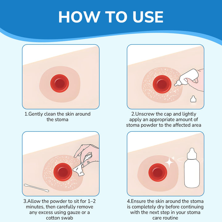 HEAGI Stoma Powder, Ostomy Skin Care Powder, Protects Skin Keep Dry Ostomy Powder Adapt Stoma Powder (25g) - HEAGI - Colostomy bags Supplies