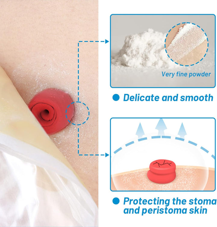 HEAGI Stoma Powder, Ostomy Skin Care Powder, Protects Skin Keep Dry Ostomy Powder Adapt Stoma Powder (25g) - HEAGI - Colostomy bags Supplies
